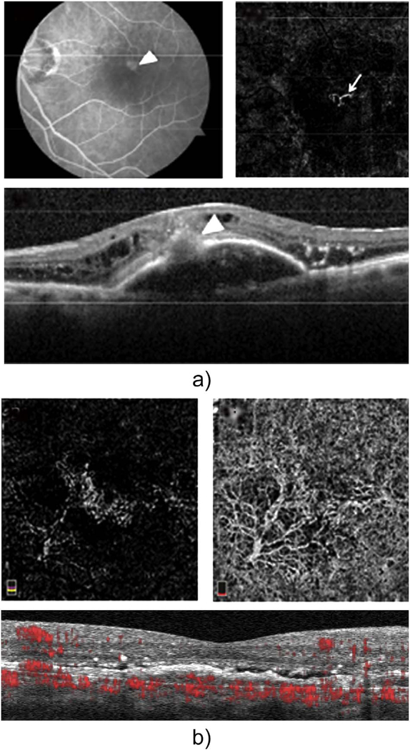 Fig. 57.