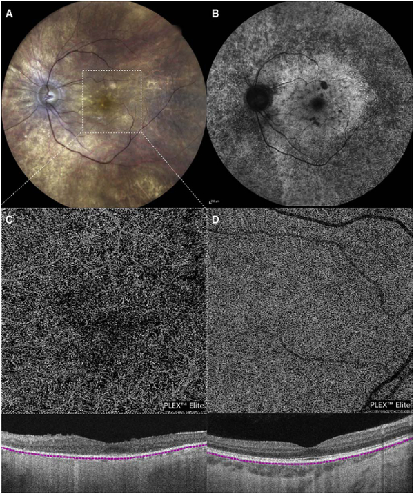 Fig. 74.