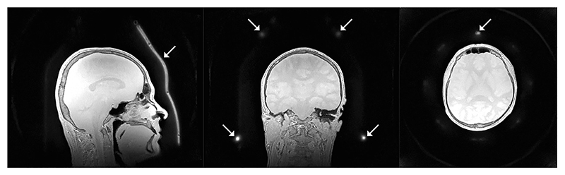 Fig. 10