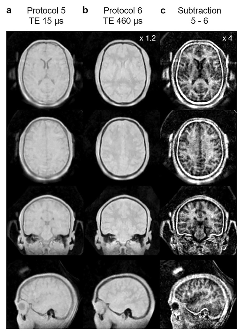 Fig. 16