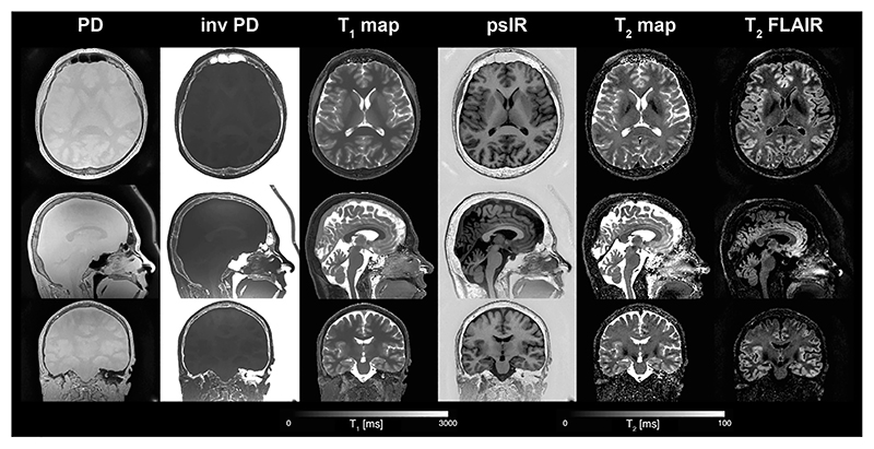 Fig. 9