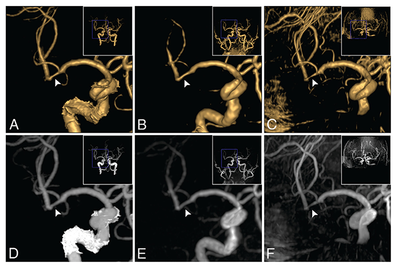 Fig. 13