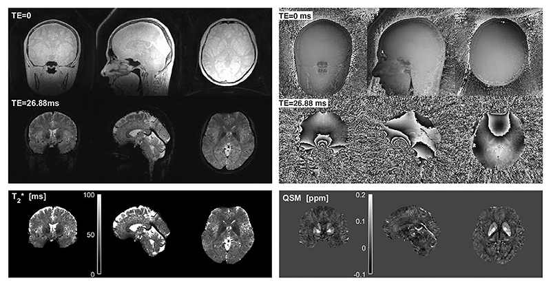 Fig. 14