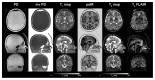 Fig. 9