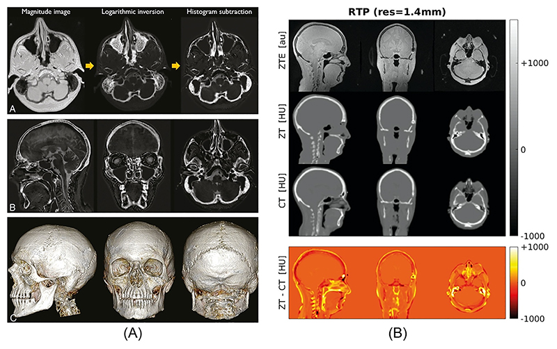 Fig. 15