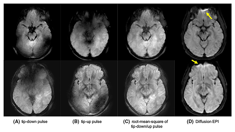 Fig. 11