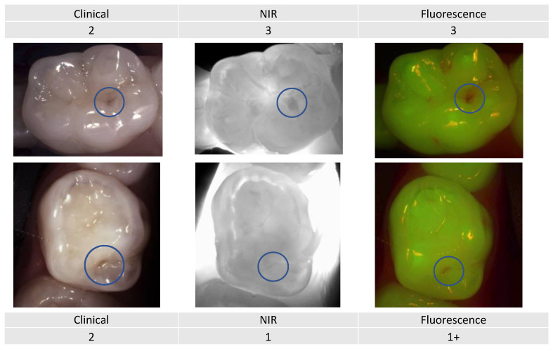 Figure 11