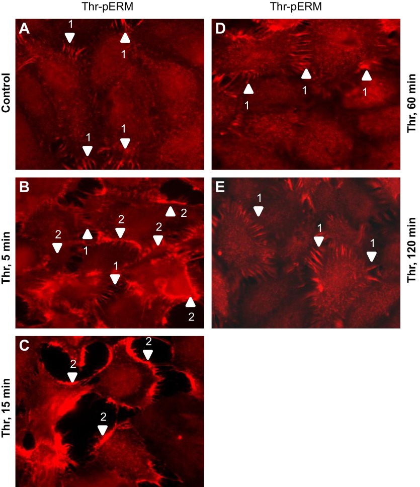 Fig. 11.