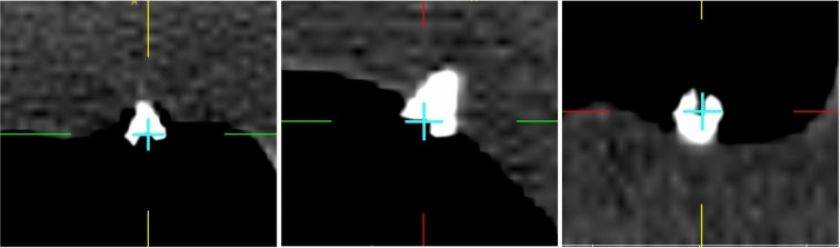 Fig. 9