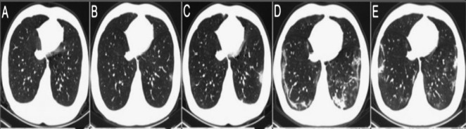 Fig. 1