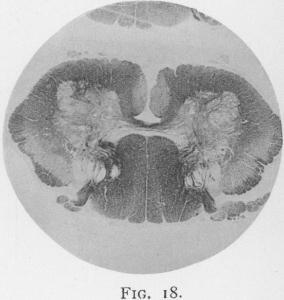 Fig. 18