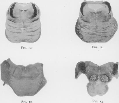 Figs. 10,11,12 and 13