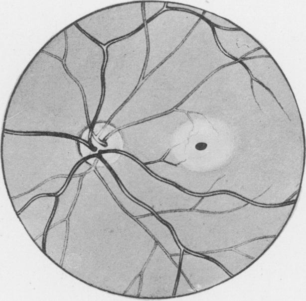 Fig. 21