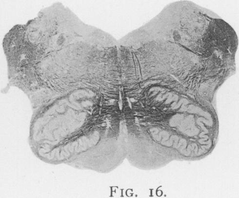 Fig. 16