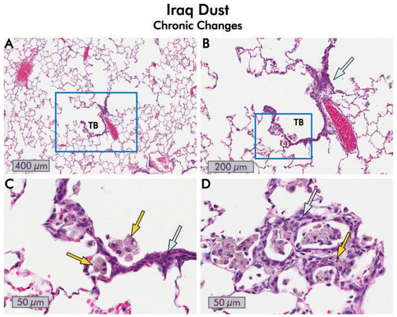 FIGURE 11