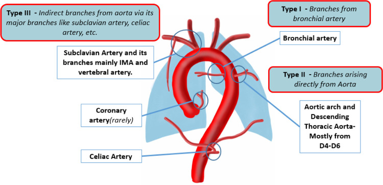 Diagram representing the common sites of major aortopulmonary collateral arteries origin and classification. D4–D6 = dorsal vertebrae 4 to 6, IMA = internal mammary artery. (Reprinted, with permission, from reference 17.)