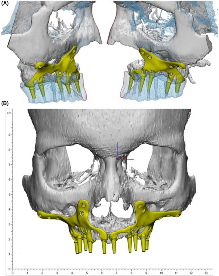 FIGURE 3