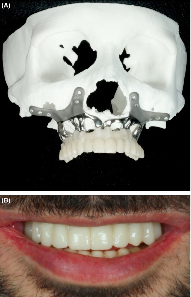 FIGURE 6