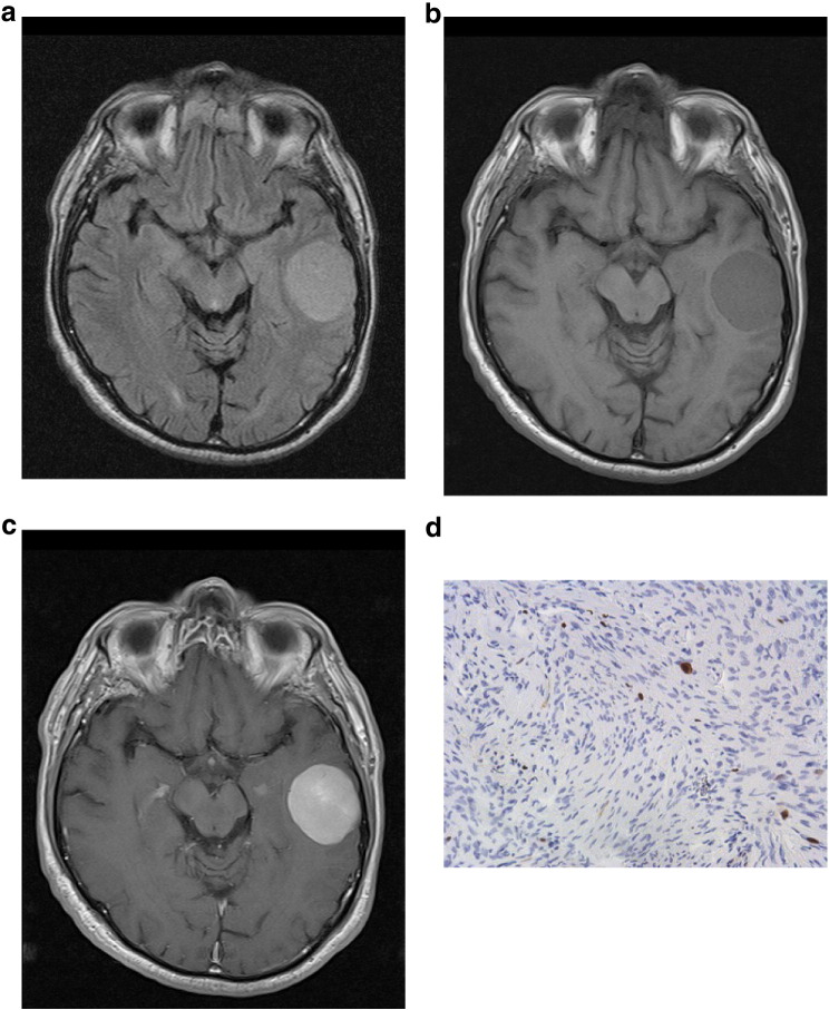 Figure 1