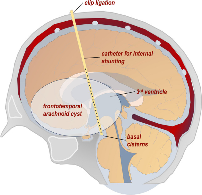 Fig. 1