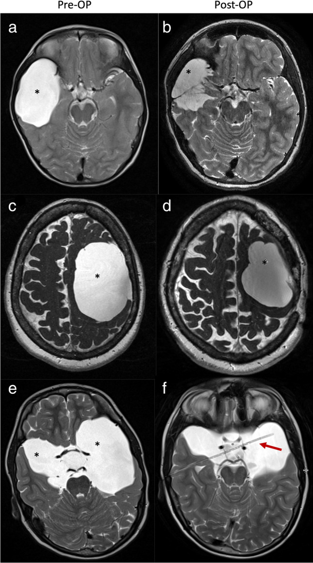 Fig. 4