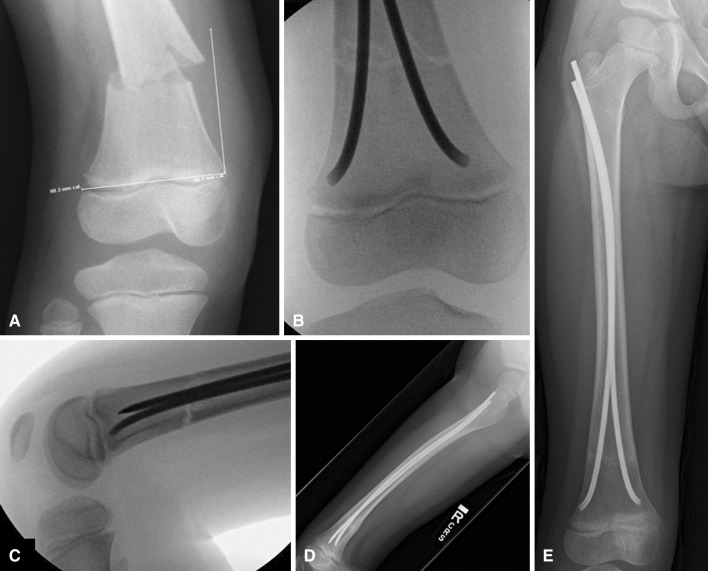 Fig. 3A–E