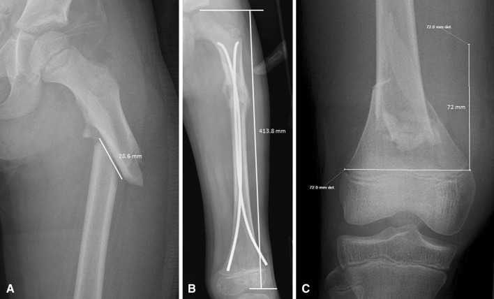 Fig. 1A–C