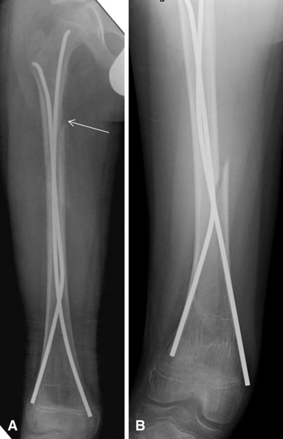 Fig. 5A–B