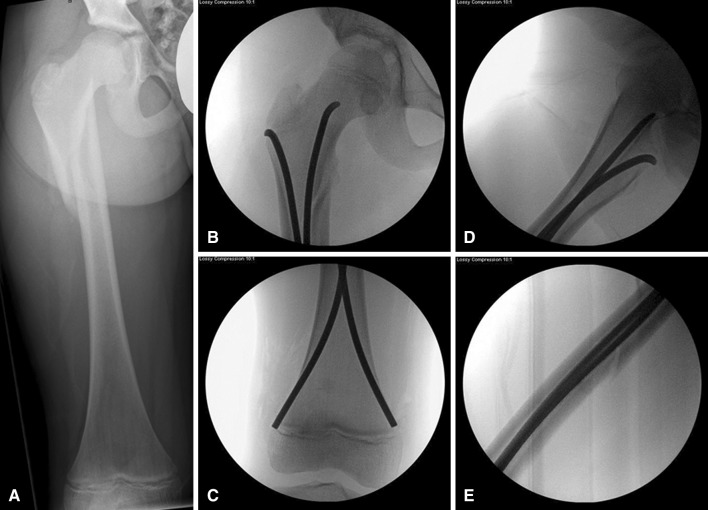 Fig. 2A–E