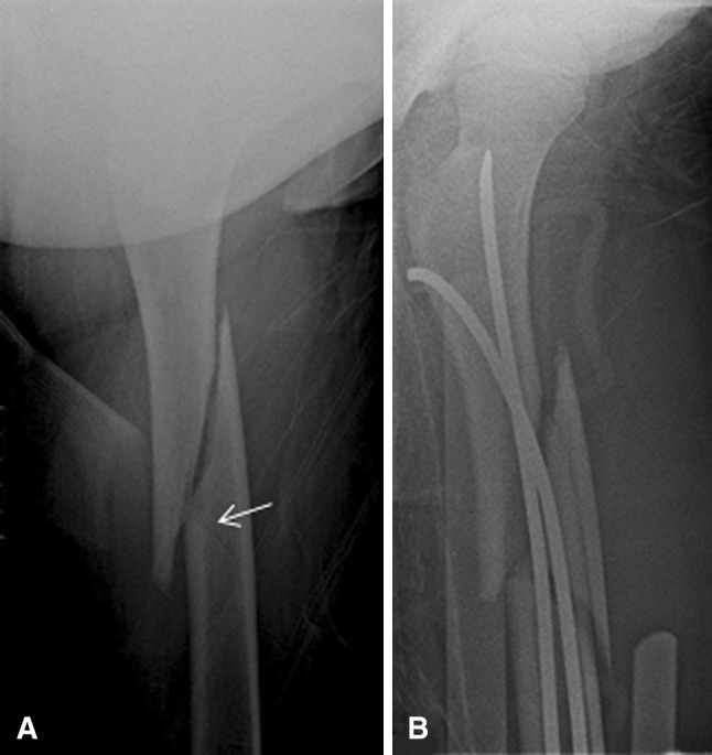 Fig. 4A–B