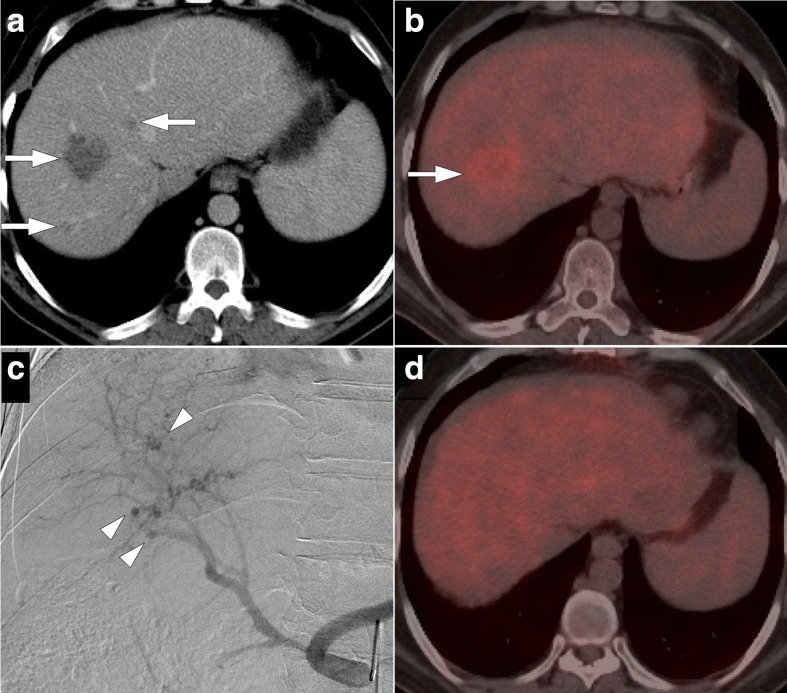 Figure 13.