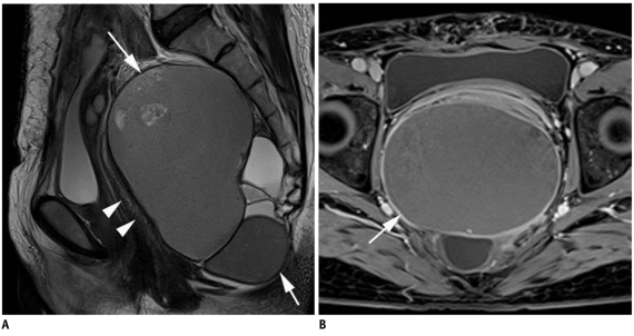 Fig. 11