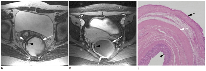 Fig. 13