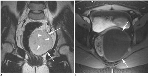 Fig. 14