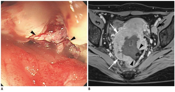 Fig. 15