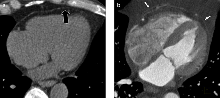 Figure 1. a, b