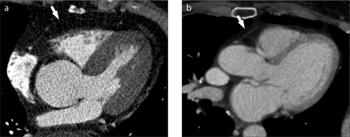 Figure 3. a, b