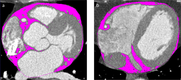 Figure 2. a, b