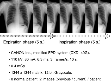 Fig 1