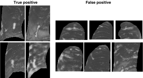 Fig 10