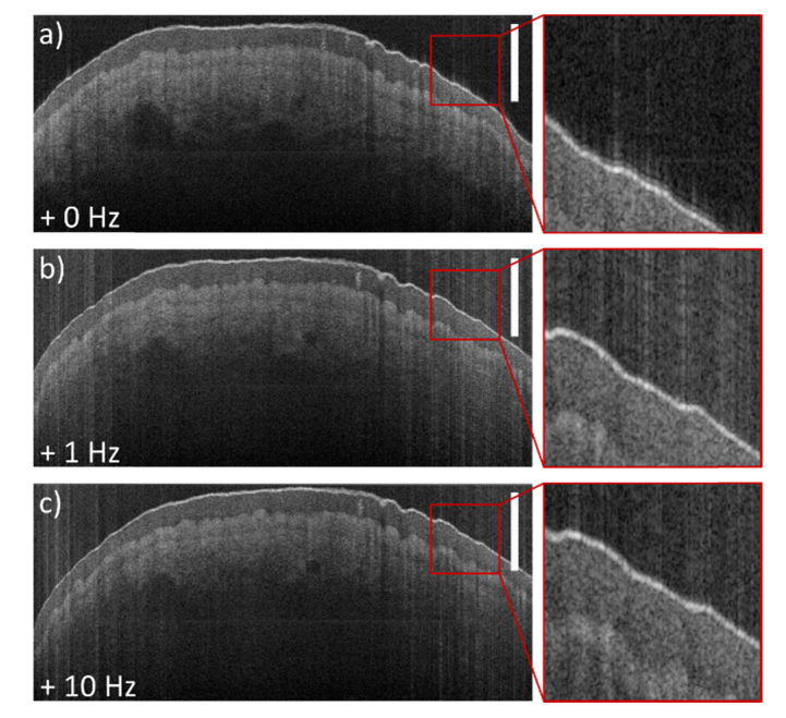 Fig. 15