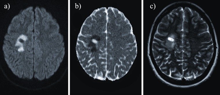 Fig. 11