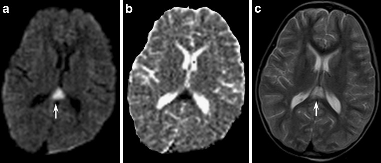 Fig. 10