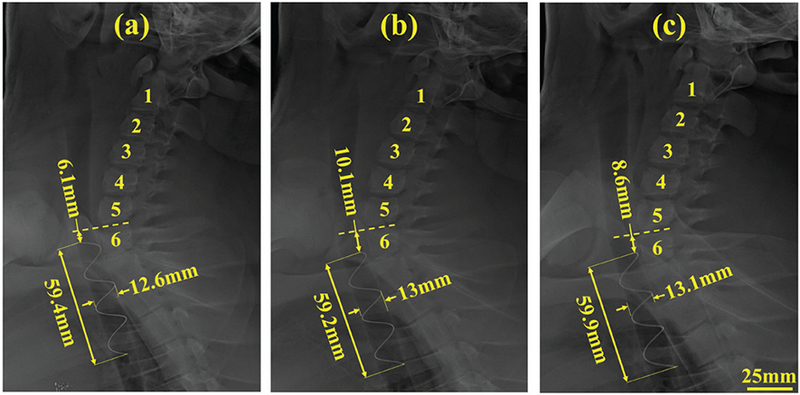 Fig. 14.