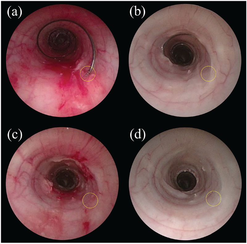 Fig. 13.