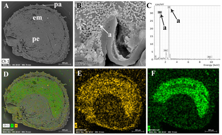 Figure 11