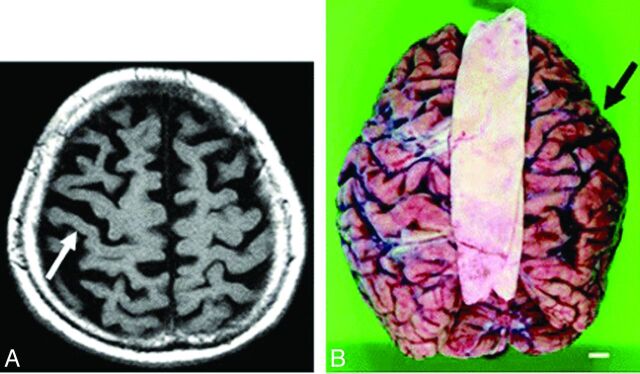 Fig 1.