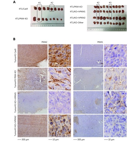 Tumor images of 4T1/Cas9, 4T1/PKM-KO, 4T1/KO+hPKM1 and 4T1/KO+hPKM2 cells inoculated in BALB/c mice for 26 days. # indicates tumors used for immunohistochemistry staining. (B) Staining of 4T1/Cas9, 4T1/PKM-KO, 4T1/KO+hPKM1 and 4T1/KO+hPKM2 tumors for PKM2 or PKM1. High-power micrographs of the same tumors were shown in the right.