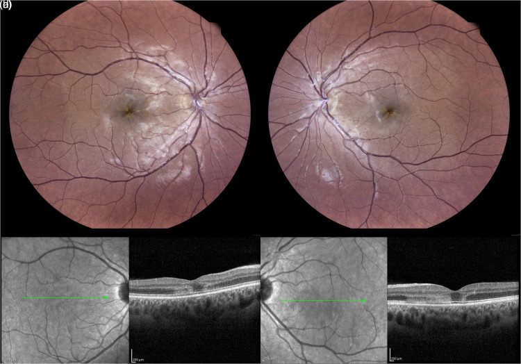 Figure 3.