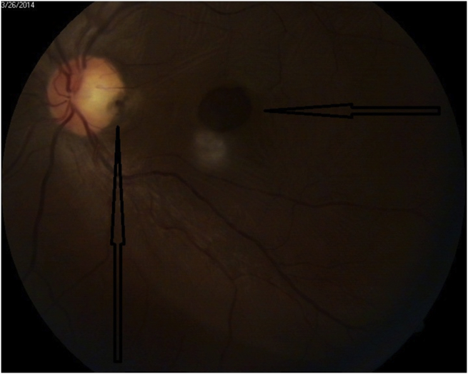 Fig. 2